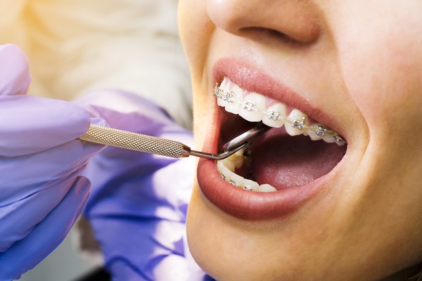 braces specialist in Panch Pakhadi